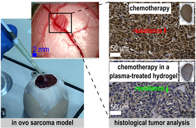 New paper on the use of plasma-treated, chemotherapy-loaded hydrogels as a novel approach to local tumor management